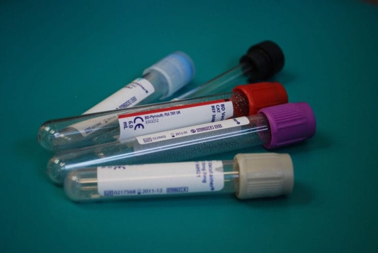 Ce analize medicale arată sănătatea rinichilor Ce analize medicale arată sănătatea rinichilor