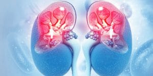 Legătura dintre hipertensiune și bolile renale